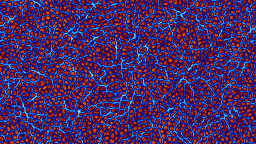 physarum (2).png